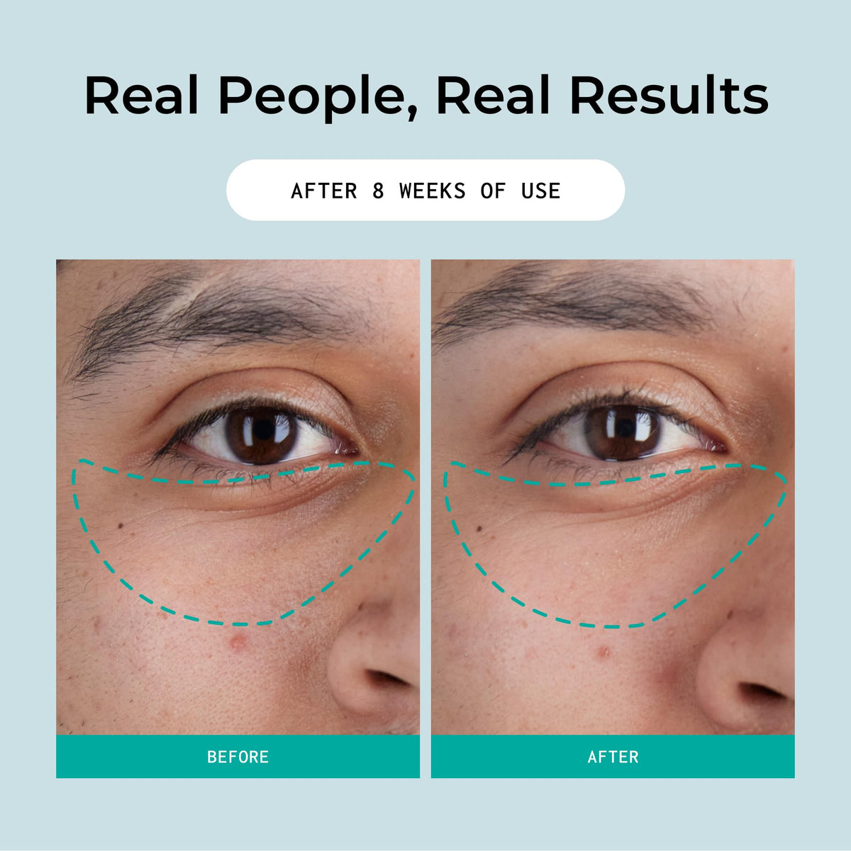 Eye contour close-up with red algae in Bigger Than Beauty Defying Gravity cream