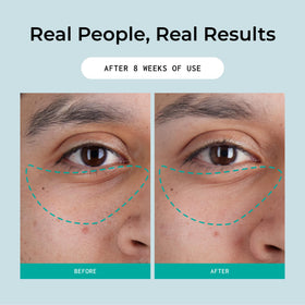 Eye contour close-up with red algae in Bigger Than Beauty Defying Gravity cream