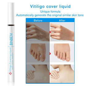 BINBEIV Vitiligo Cover Liquid waterproof finish on skin.