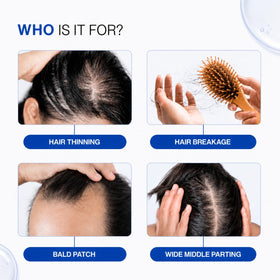 Bio Mystery ingredients blend close-up features Redensyl, Anagain, Biacapil for scalp care.