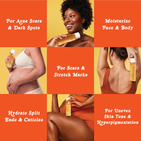 Bio-Oil ingredients rosehip and chia provide hydration.