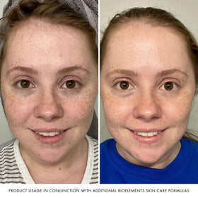 Non-greasy finish providing comfortable, breathable hydration for daytime use.