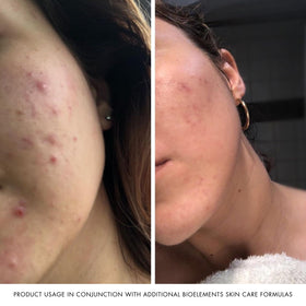 Bioelements Cleanser ingredients closeup with Chinese herbs and essential oils
