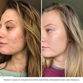 Bioelements RayDefense packaging highlights vegan, gluten-free, cruelty-free credentials.