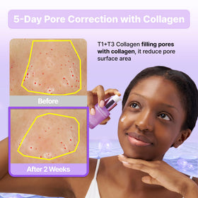 BIOHEAL BOH Probioderm serum ingredients illustration highlighting collagen peptides.