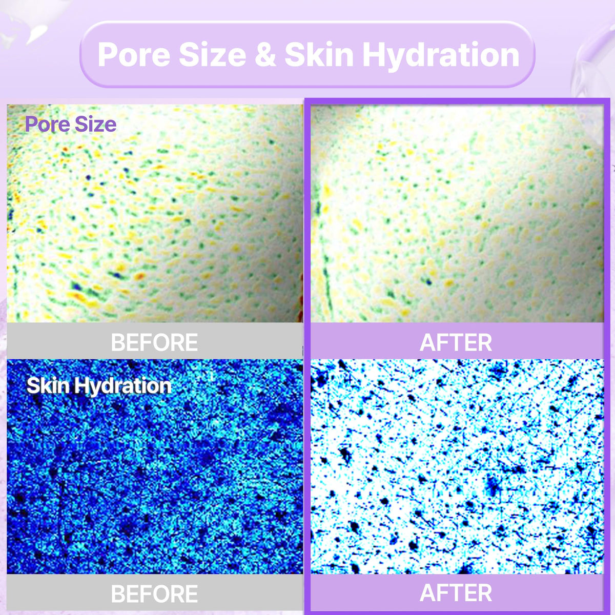 BIOHEAL BOH PROBIODERM mask on the face during application for hydration