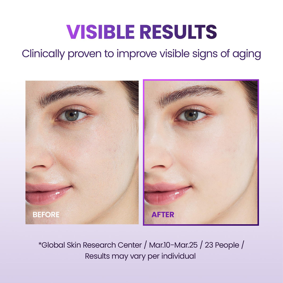 BIOHEAL BOH Probioderm probiotic complex application on skin for resilience.