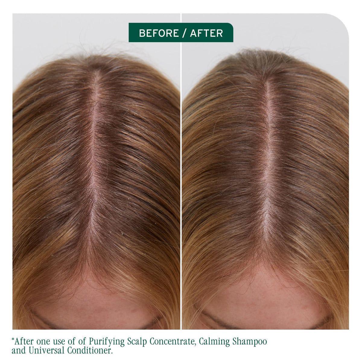 Biolage Scalp Sync Calming Shampoo rich lather soothing dry scalp during wash