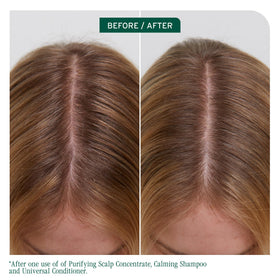 Biolage Scalp Sync Calming Shampoo rich lather soothing dry scalp during wash