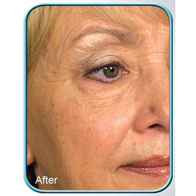 Biologic Solutions Phyko-AI-PF component illustration highlights skin cell production support.