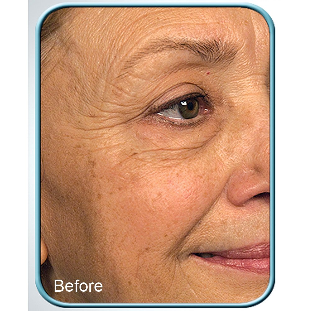 Biologic Solutions Stem Cell Therapy Cream texture close-up; silky formula for daily application.