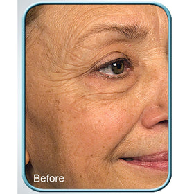 Biologic Solutions Stem Cell Therapy Cream texture close-up; silky formula for daily application.