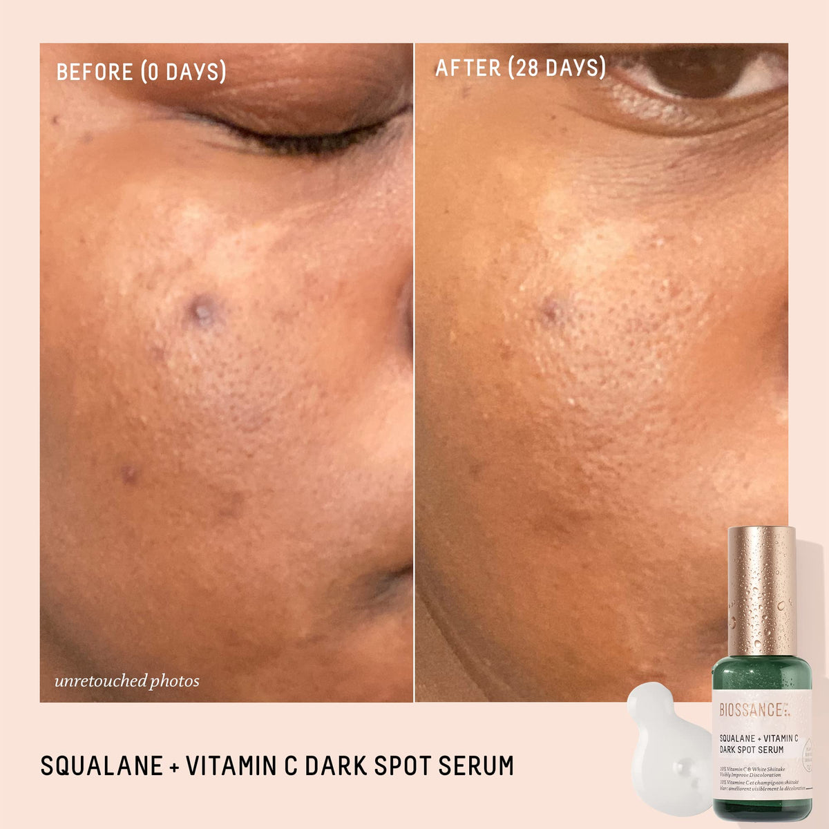 BIOSSANCE Squalane + Vitamin C Dark Spot Serum on skin shows radiant glow and even tone.