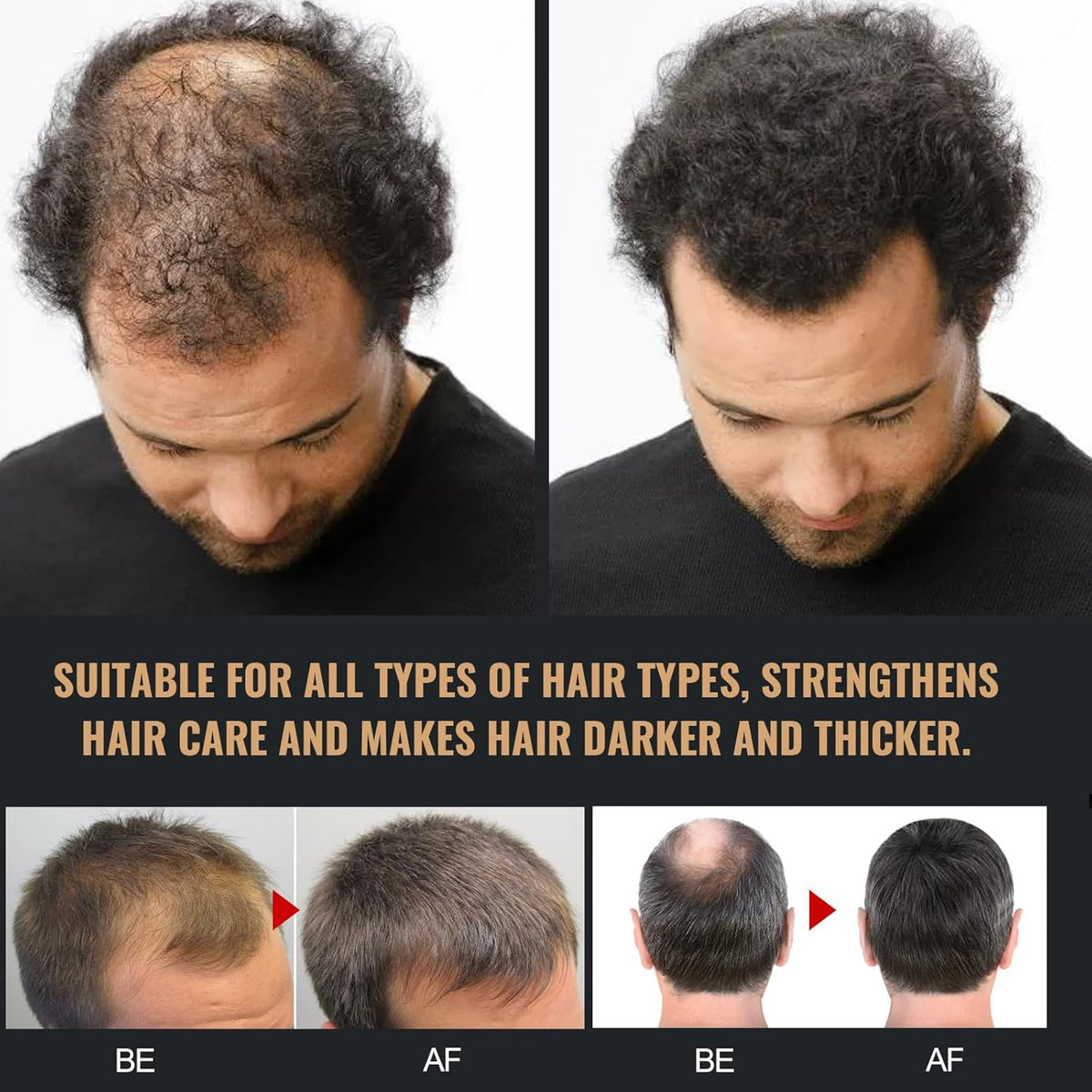 Biuhorey Root Activator Shampoo natural ingredients label highlights plant extracts used.