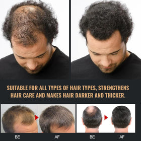 Biuhorey Root Activator Shampoo natural ingredients label highlights plant extracts used.