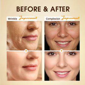 BIYSBER serum dropper close-up for precise application