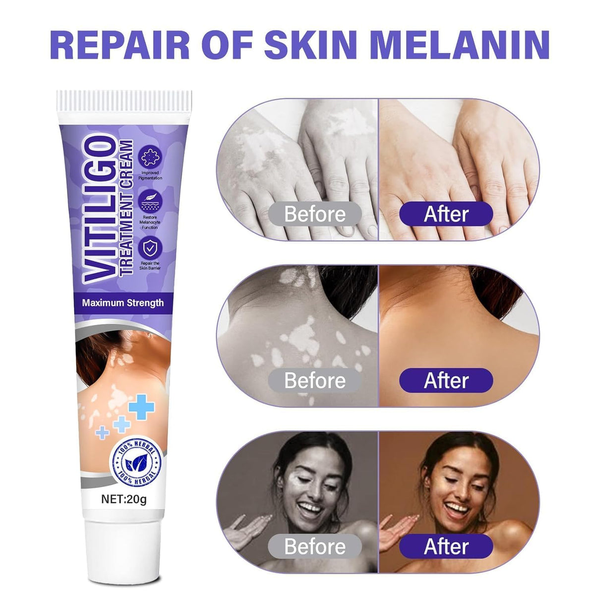 Bizzico Vitiligo Cream texture closeup shows creamy, light feel on the skin.