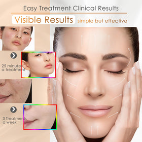 Blanight Photon Skin Mask side view showing compact design and easy fit.