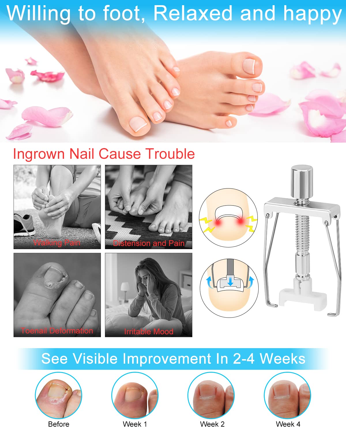 BLATOWN toenail corrector sticker bundle provides placements for multiple nails.