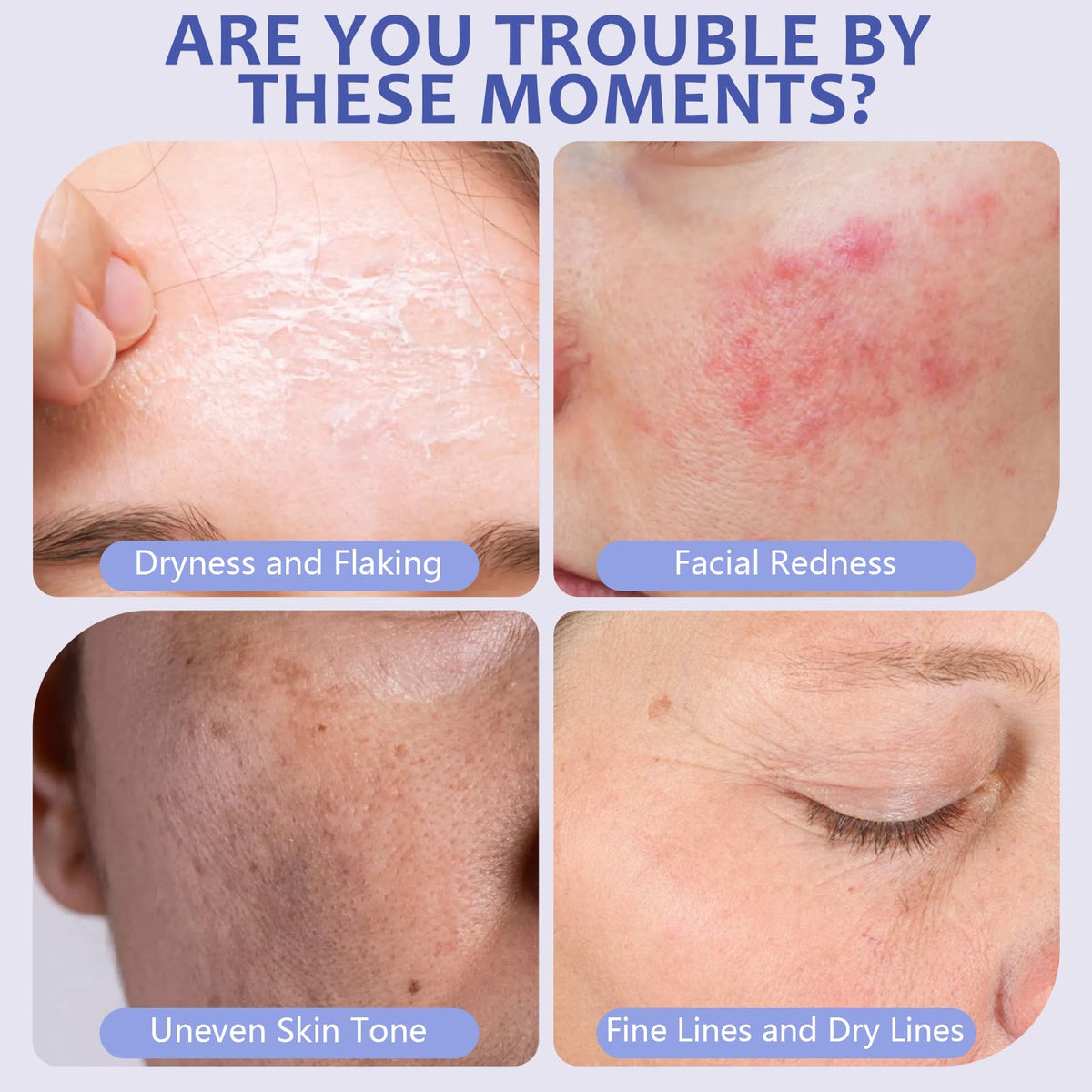 BlissAura Dewy Skin Cream applied on face for smooth, hydrated skin.