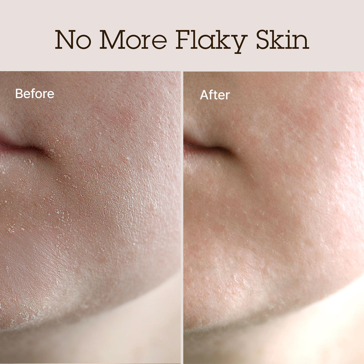 BLITHE label highlights suitability for normal to dry skin care.