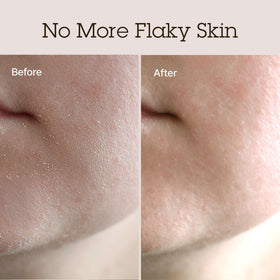 BLITHE label highlights suitability for normal to dry skin care.