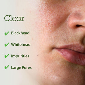 BLITHE pore care formula helps reduce debris and refine pore appearance.