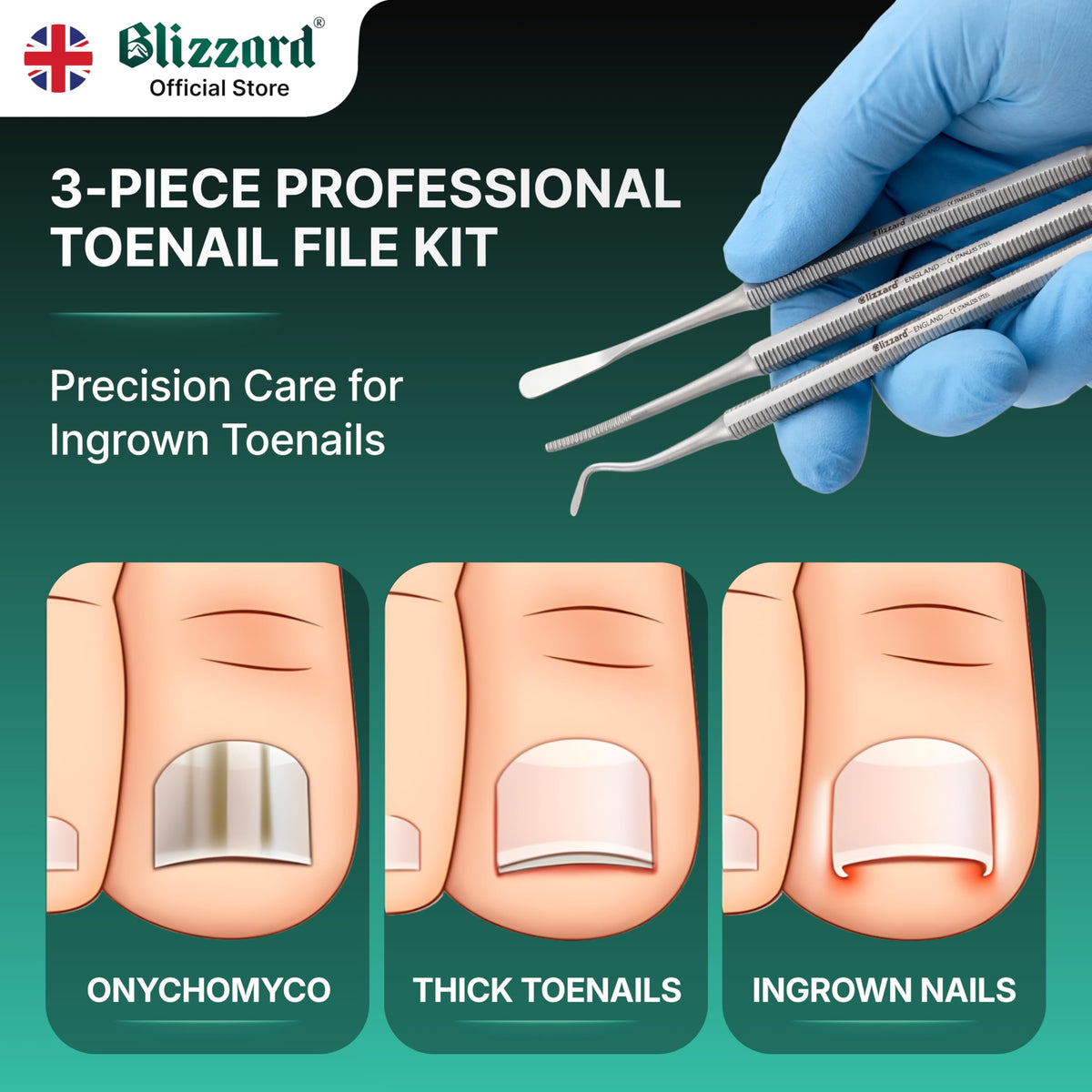 Blizzard double-ended black file with angled head smooths painful nail edges.