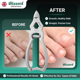 Blizzard barrel spring provides smooth operation during trims.