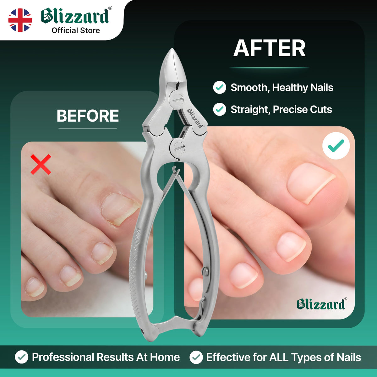 Blizzard podiatry-grade stainless steel enables safe sterilization and durability