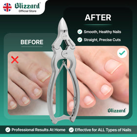 Blizzard podiatry-grade stainless steel enables safe sterilization and durability