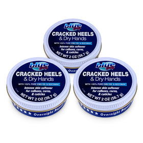 Blue Goo cracked heels balm in a 2 oz jar soothing dry skin.