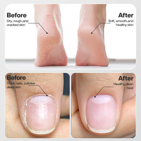 Blue Sea Sky dust cover helps reduce nail dust during filing.