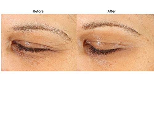 Bluelene EyePlus+ hydration scene demonstrates deep moisture retention and plump look.