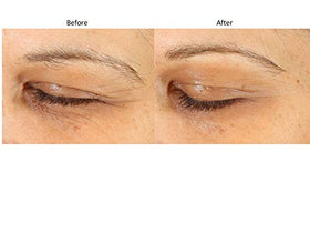 Bluelene EyePlus+ hydration scene demonstrates deep moisture retention and plump look.