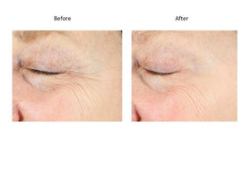 Bluelene EyePlus+ under-eye area demonstrates potential reduction of puffiness and brighter appearance.