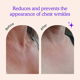 BLUMBODY chest patch conforms to multiple cup sizes for comfort