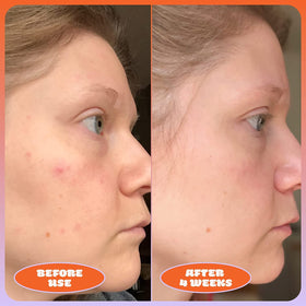 Ingredients panel featuring niacinamide and vitamin C