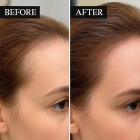 Boaccy Hair Regrowth System morning routine scene for easy daily use.