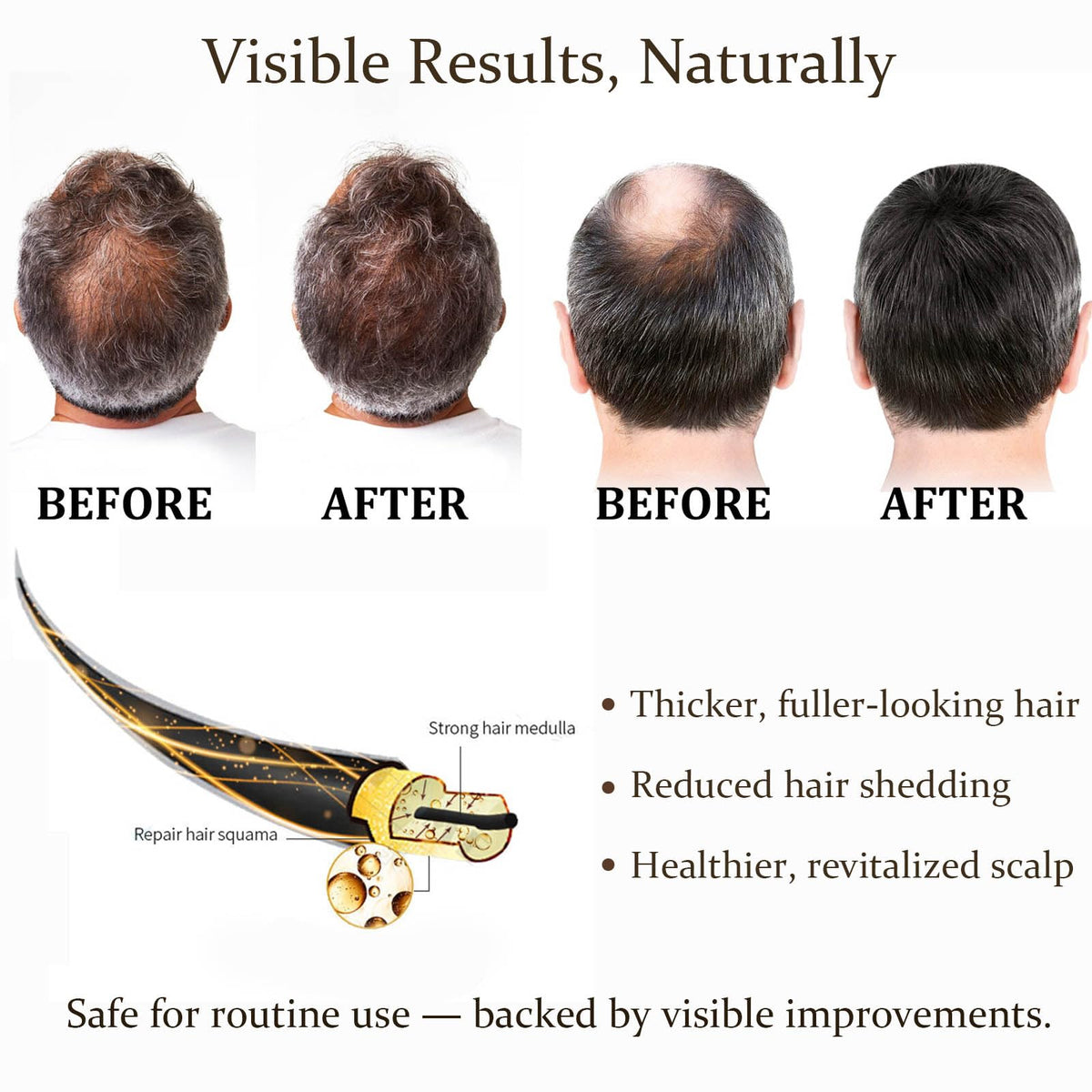Boaccy Hair Regrowth System scalp massage shows quick absorption without greasiness.