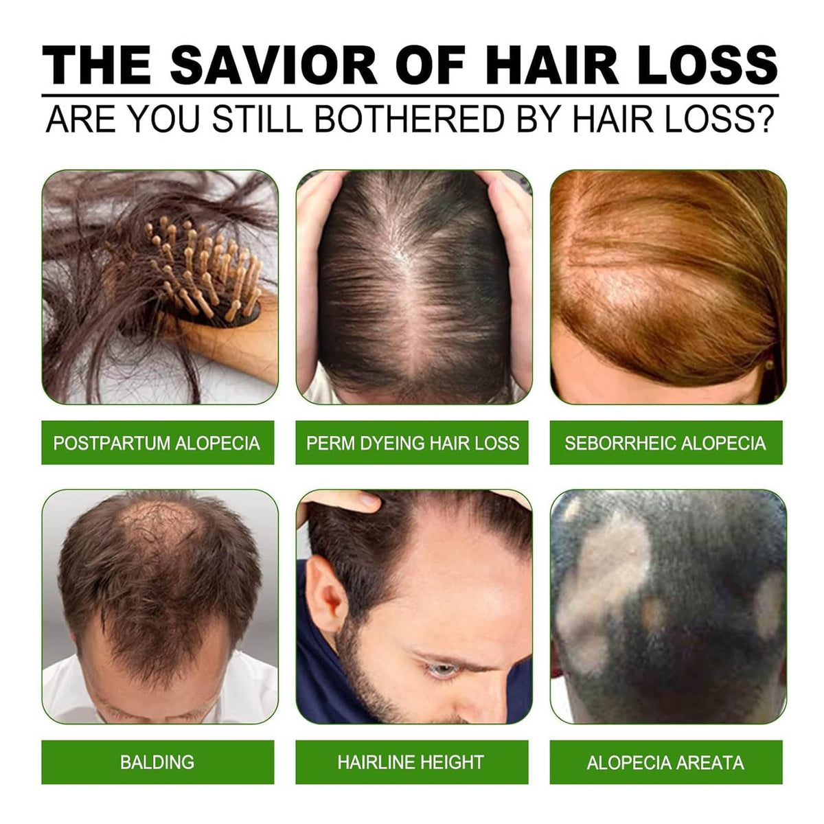 Boaccy Hair Regrowth System texture closeup shows light, non-greasy feel.