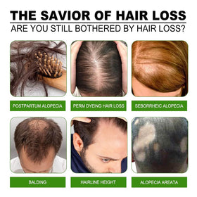 Boaccy Hair Regrowth System texture closeup shows light, non-greasy feel.