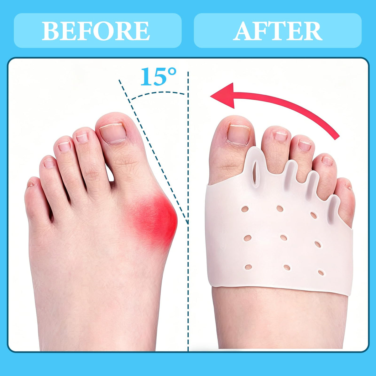 Bocello toe separators are lightweight and durable for long-lasting use and easy cleaning.