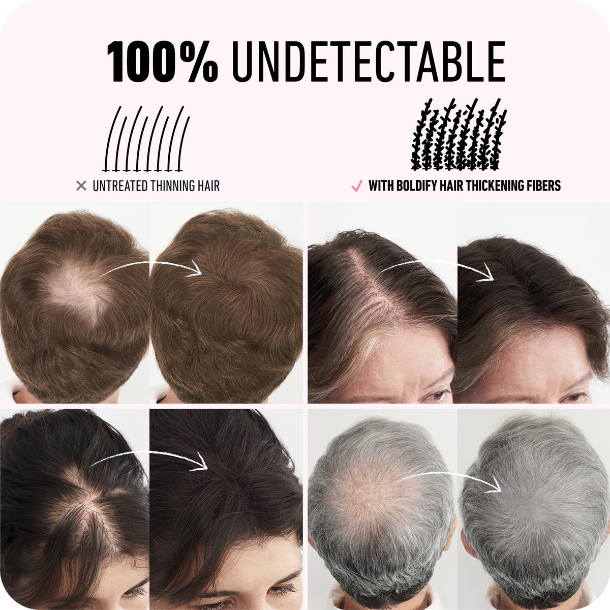 Boldify Hair Fibers vegan formula promotes cruelty-free, gentle scalp care