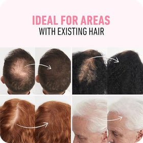 Boldify Hairline Powder edges pairing for sparse areas.