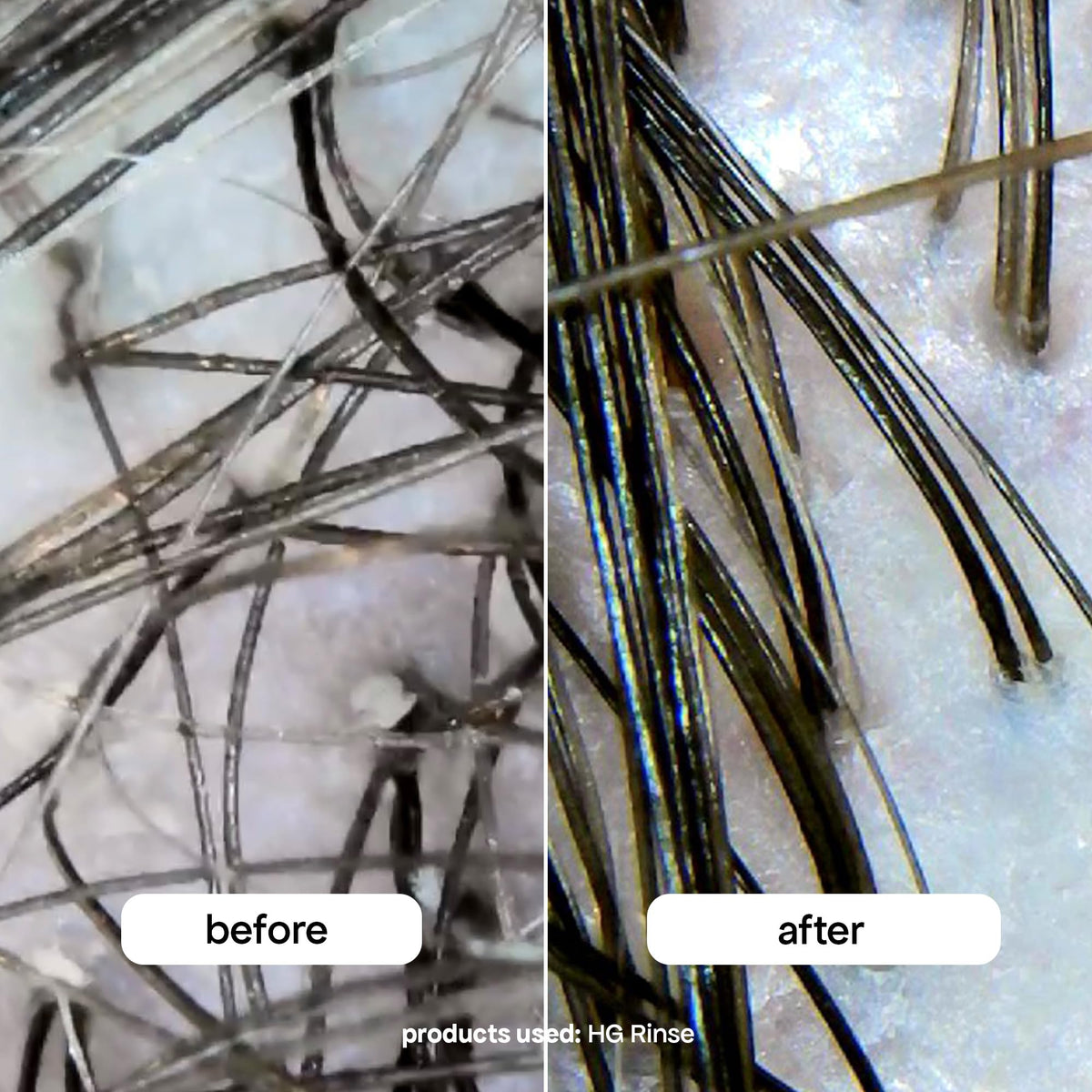 BondiBoost HG Clarifying Rinse before-after shot illustrates scalp clarity improvements.