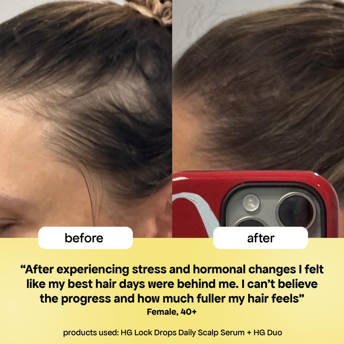 BondiBoost HG Lock Drops close-up bottle beside a healthy-looking scalp scene.