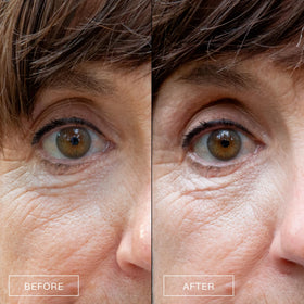 BOOM! Awaken texture close-up ready for daytime refresh.