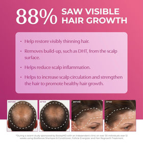 BosleyMD minoxidil foam with no-drip cap demonstrating clean, precise application.
