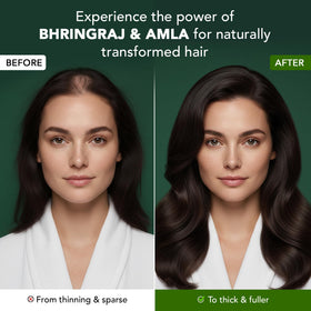 Botanic Hearth bhringraj-amla oil dropper for easy application